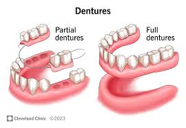 Dentures (Complete & Partial)